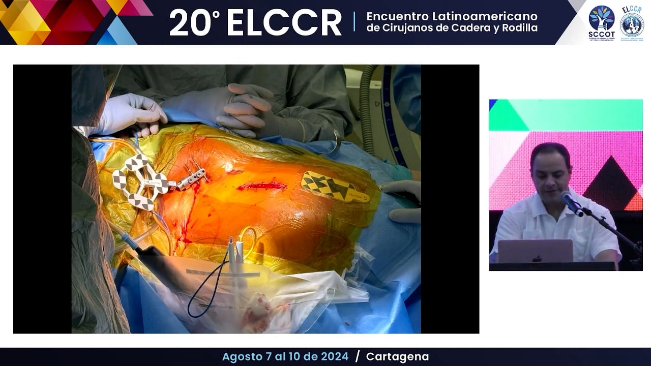 Artroplastia de cadera y rodilla con realidad virtual En qué estamos