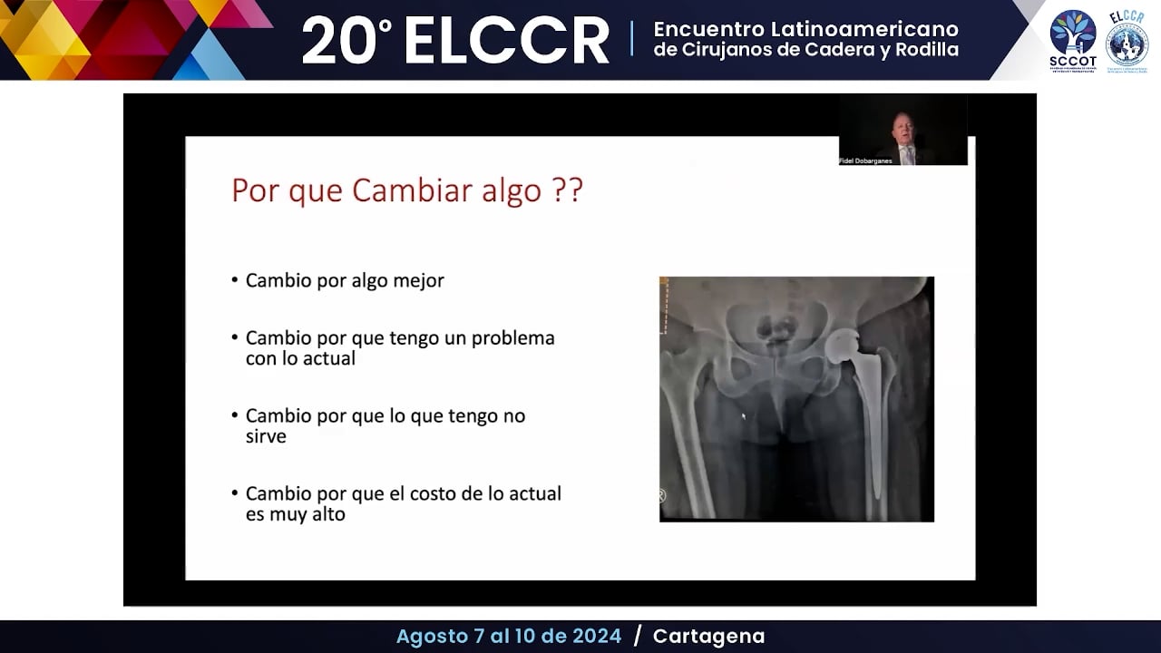 ¿Por qué no me cambio a vástagos cortos por completo?