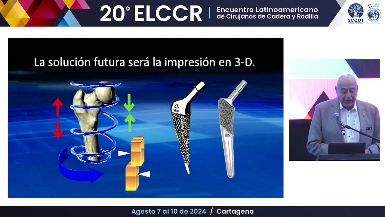 Como veo el futuro de los vástagos cortos y cuáles son los nuevos diseños