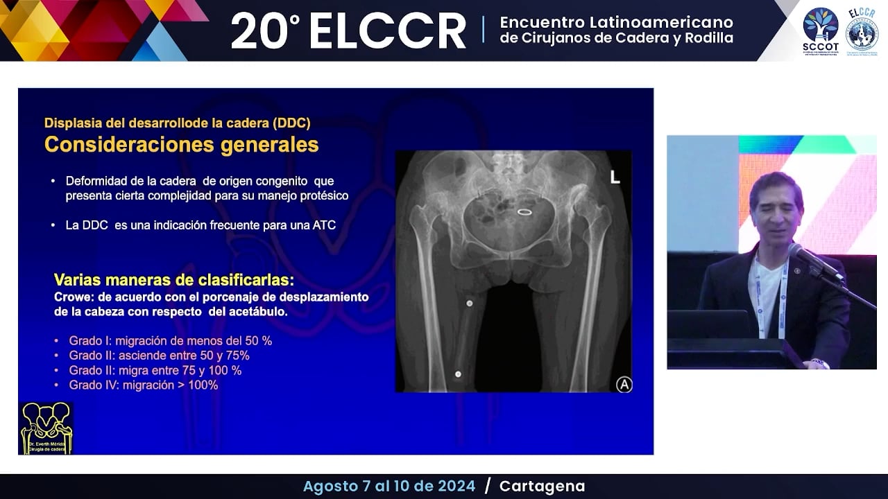 RTC en crowe IV