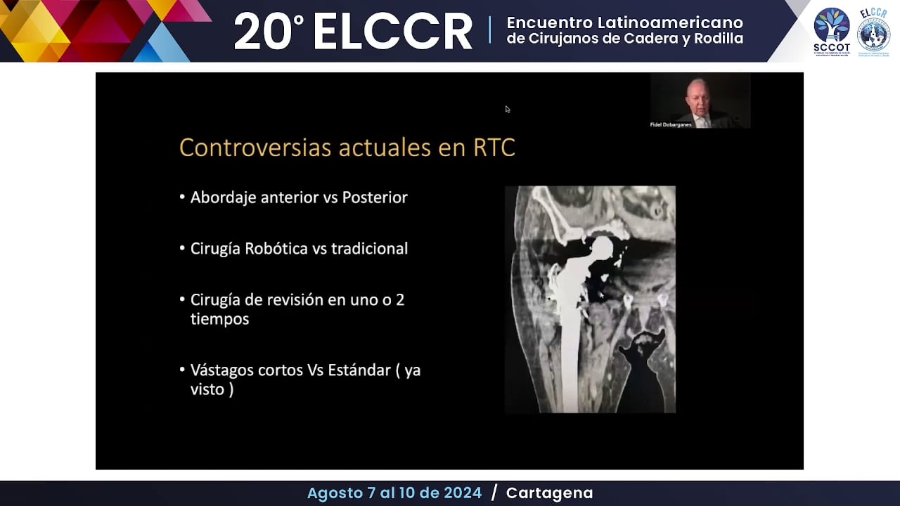 Controversias actuales en RTC. Qué dicen los registros