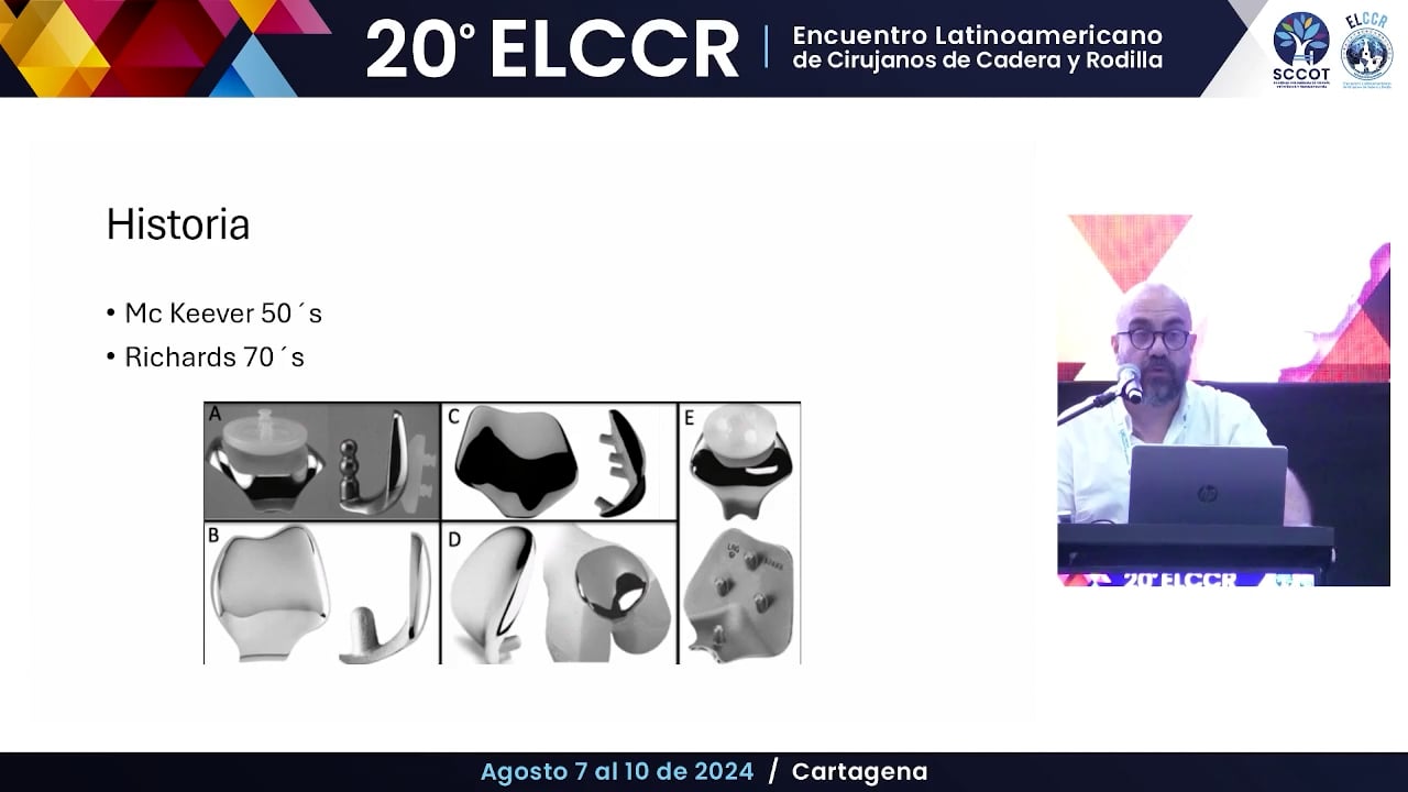 Información relevante de los registros en Artroplastia patelofemoral