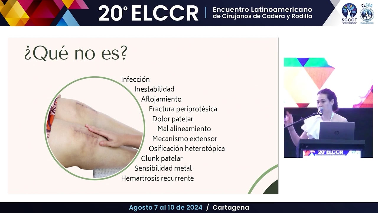 S. doloroso regional complejo post RTR. Incidencia y manejo