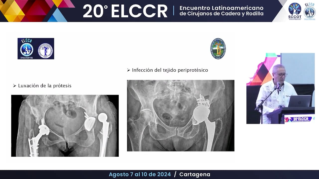 ¿Cómo prevengo la inestabilidad en las revisiones de RTC?