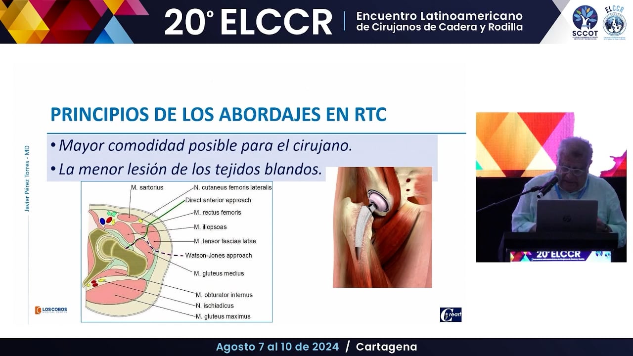 Abordaje anterolateral