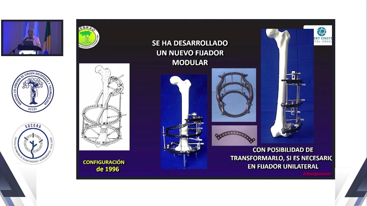 Nuestra contribución durante los últimos 37 años en la evolución del fijador externo