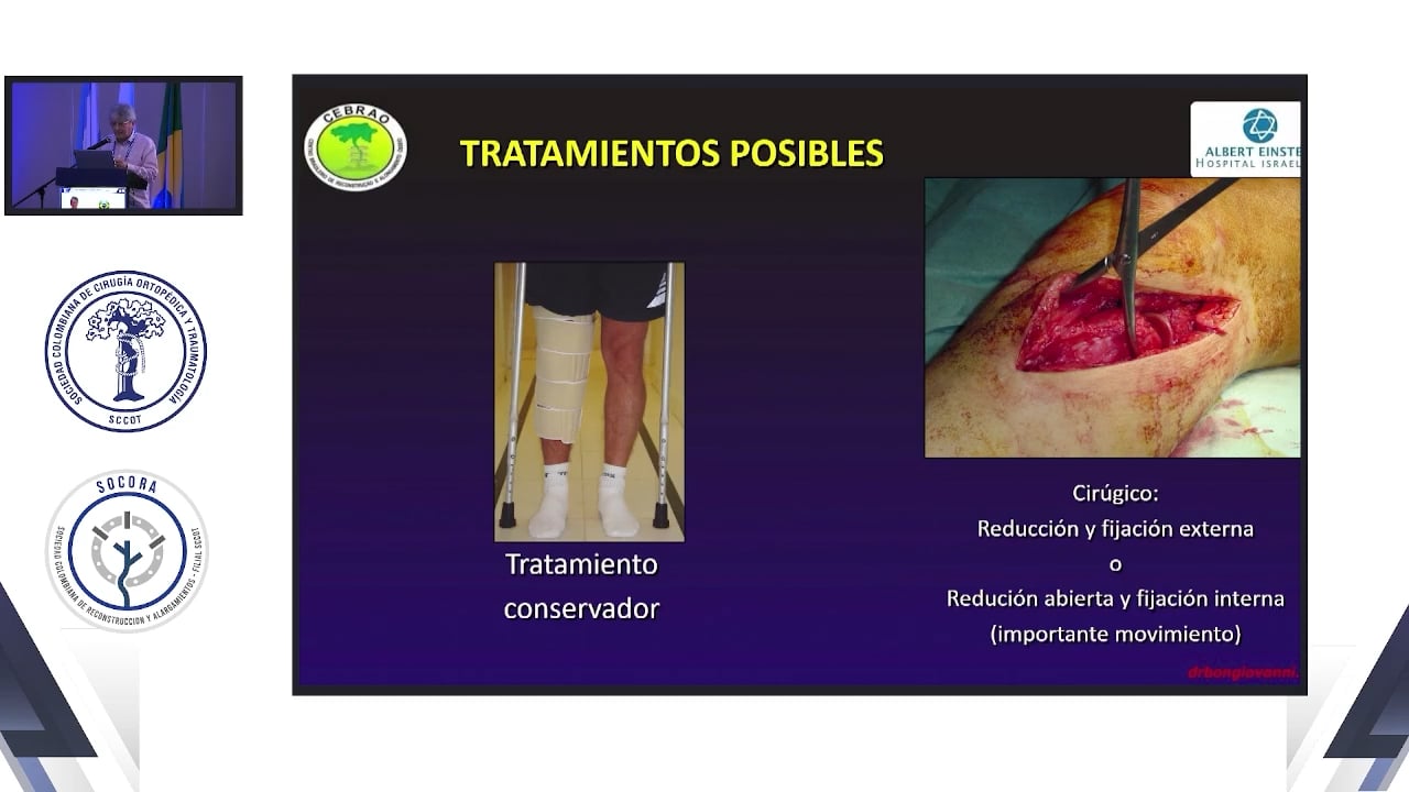 Fractura compleja de alta energía del platillo tibial