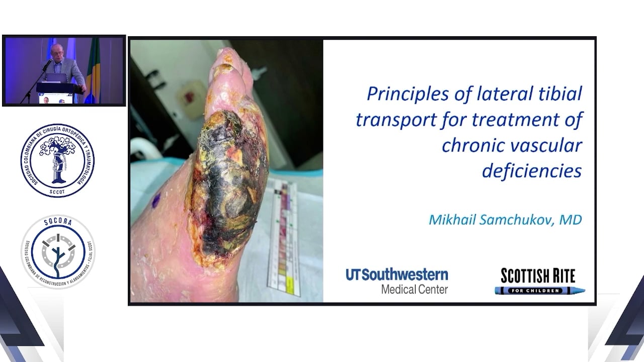 Principios del transporte tibial lateral para el tratamiento de deficiencias vasculares crónicas