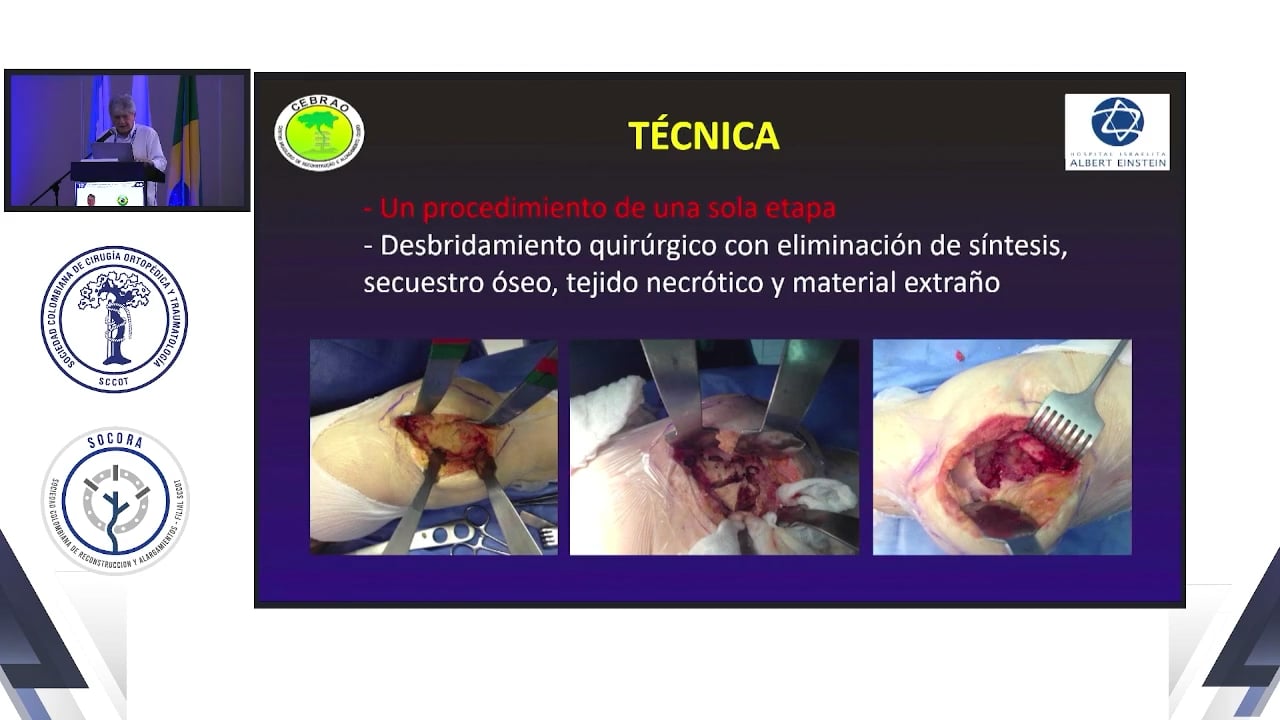 Osteomielitis crónica yo cavitaria, cómo tratar