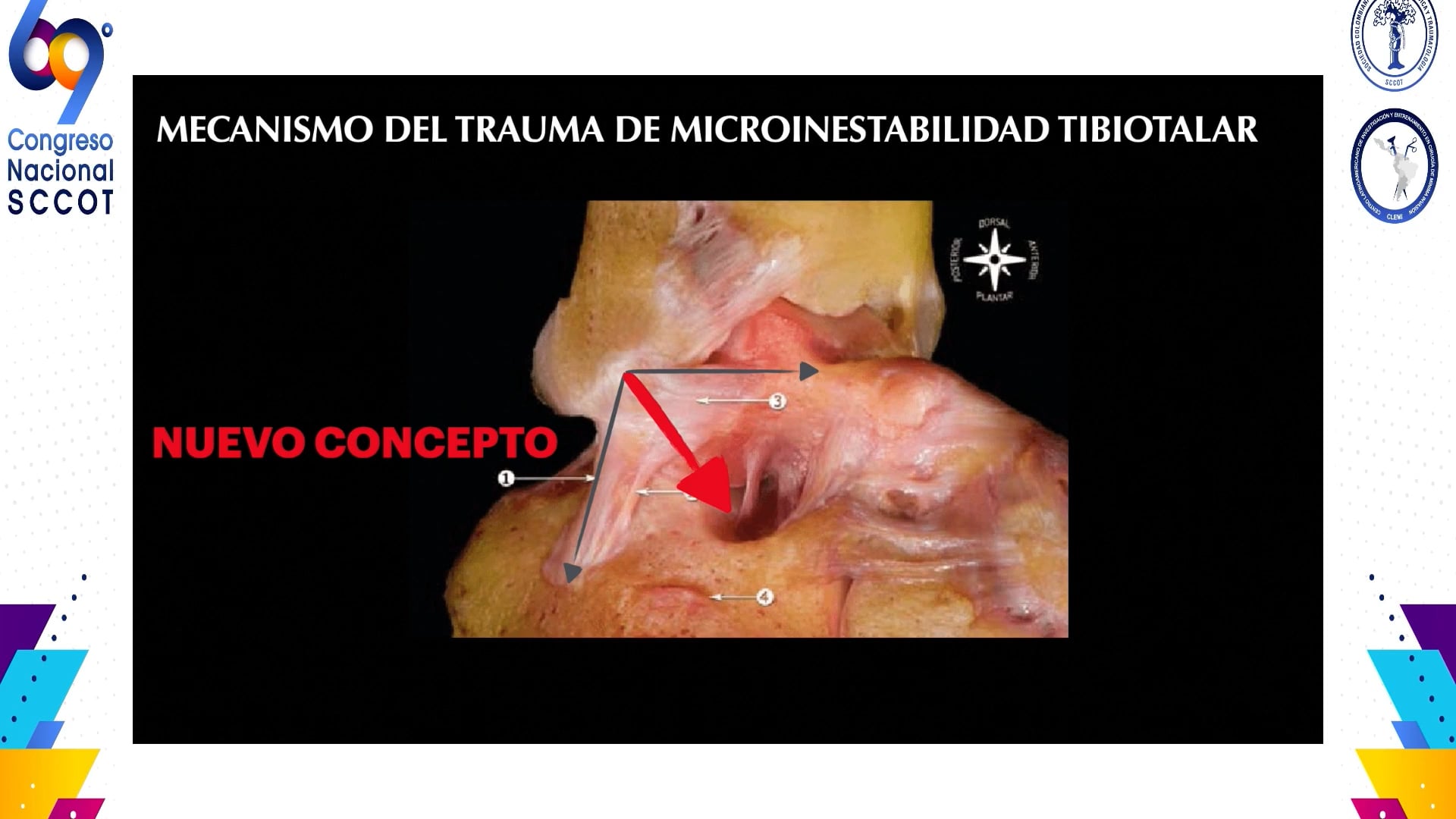 Existe la micro inestabilidad