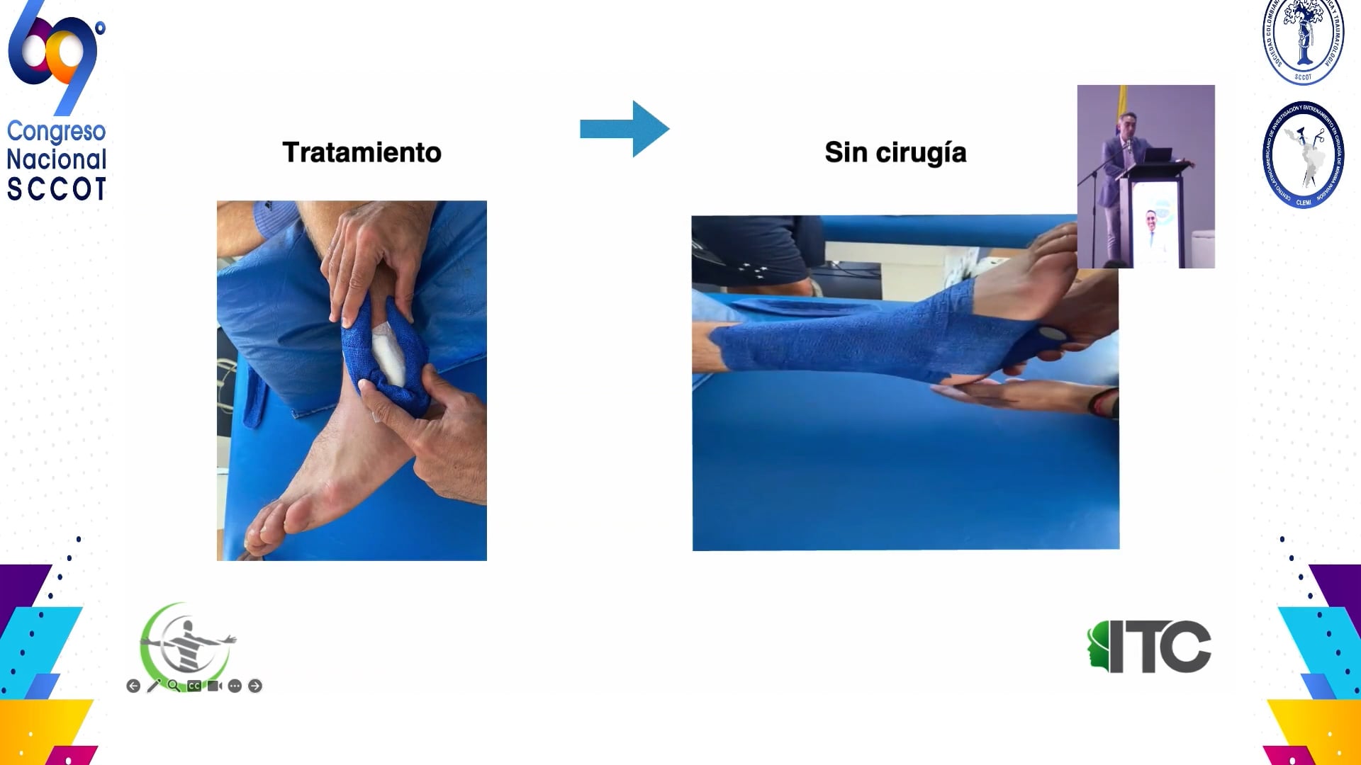 Lesión de la sindesmosis Diagnóstico y tratamiento