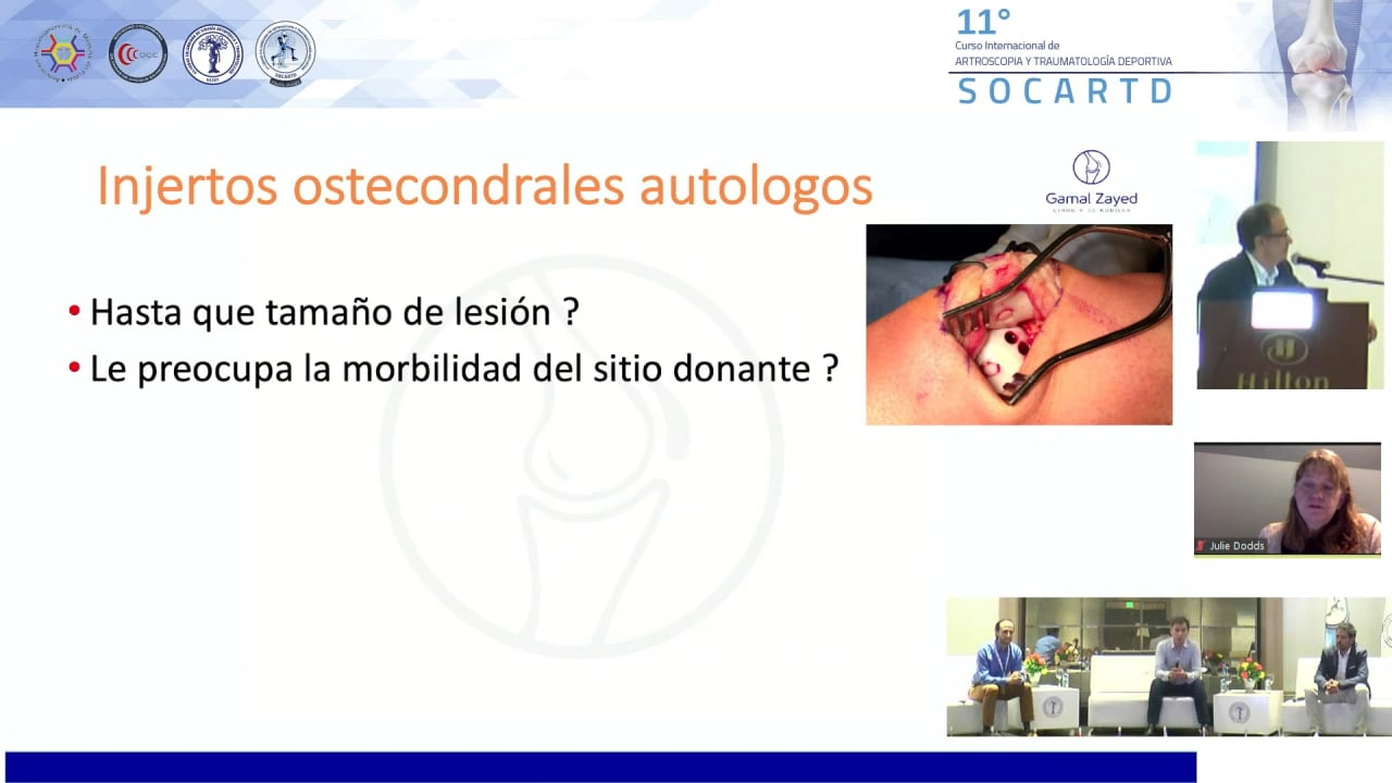 DEBATE Y CASOS CLÍNICOS  DE ARTROSCOPIA