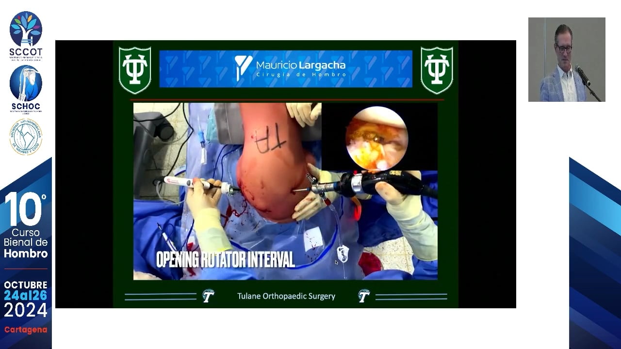 video - Bloque óseo anterior