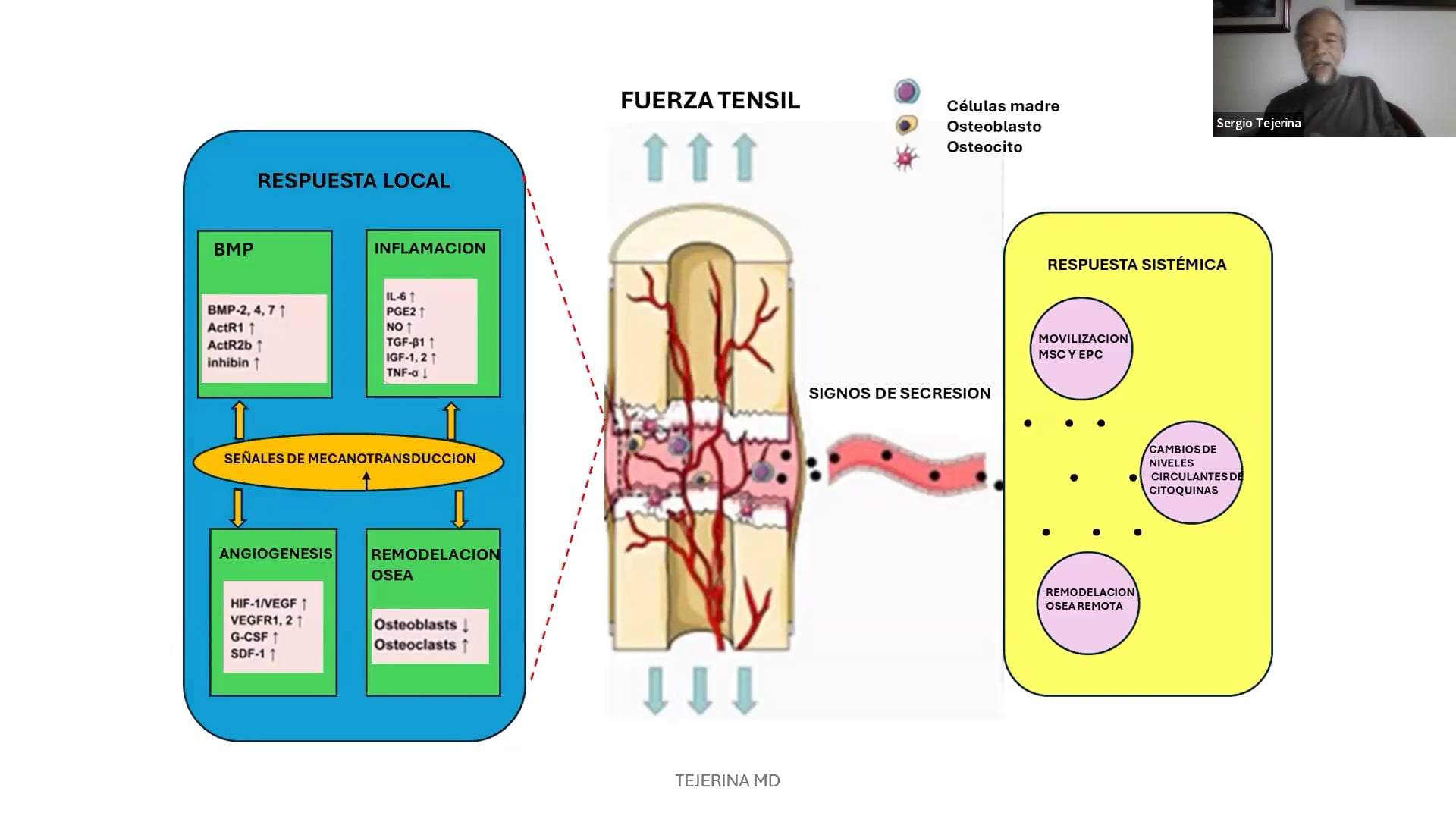 Webinar Transporte óseo tibial transverso unicortical (TTT) consideraciones generales y técnica quirúrgica final