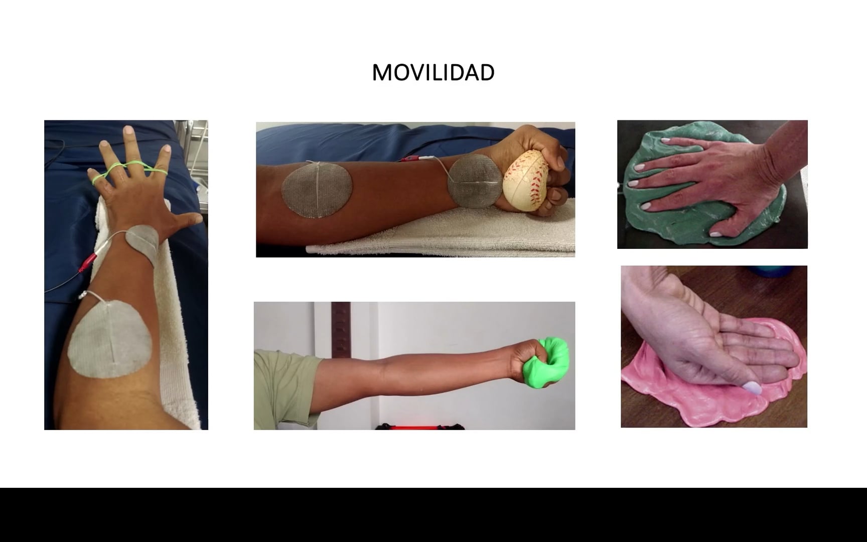 Rehabilitación perioperatorio hasta el retorno a la actividad después de lesión de muñeca