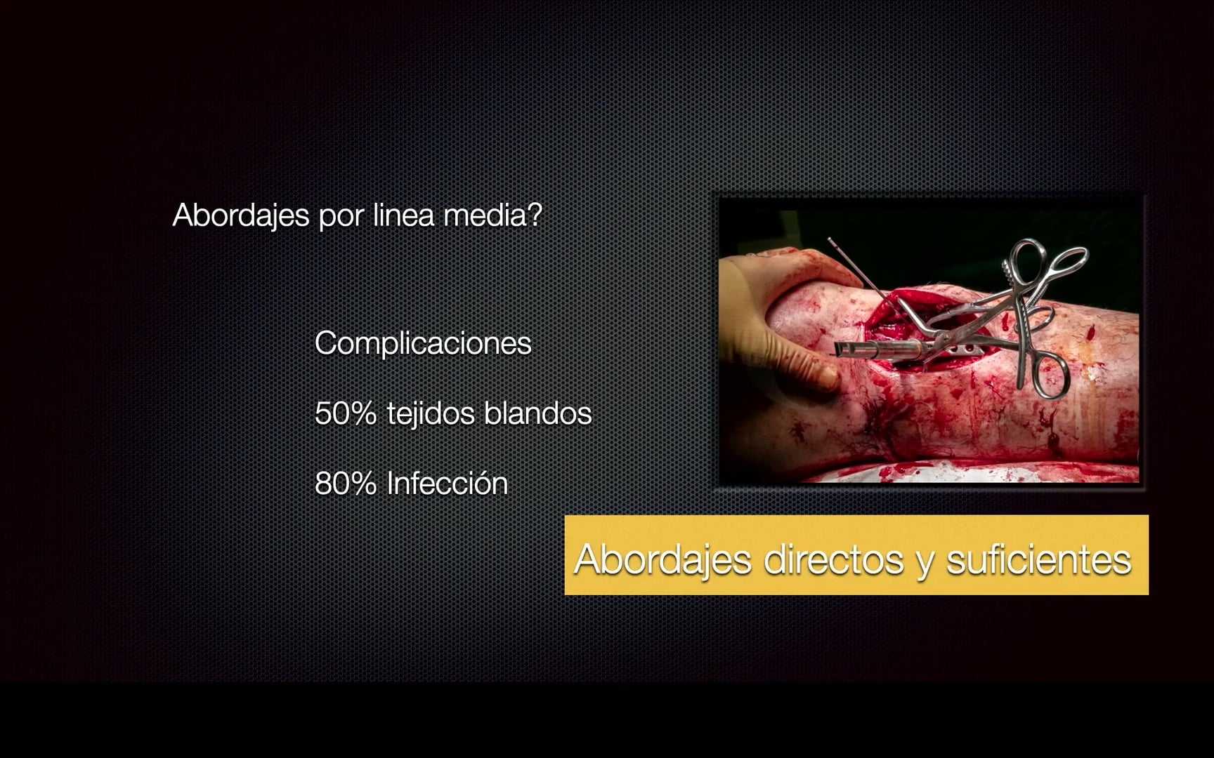 Tratamiento de la fractura de platillos tibiales y lesiones asociadas