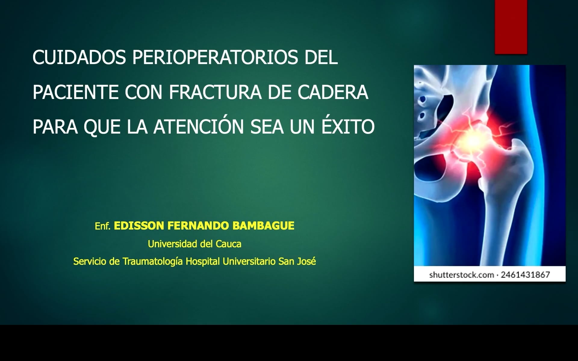 Cuidados perioperatorios del paciente con fracturas de cadera para que la atención sea un éxito