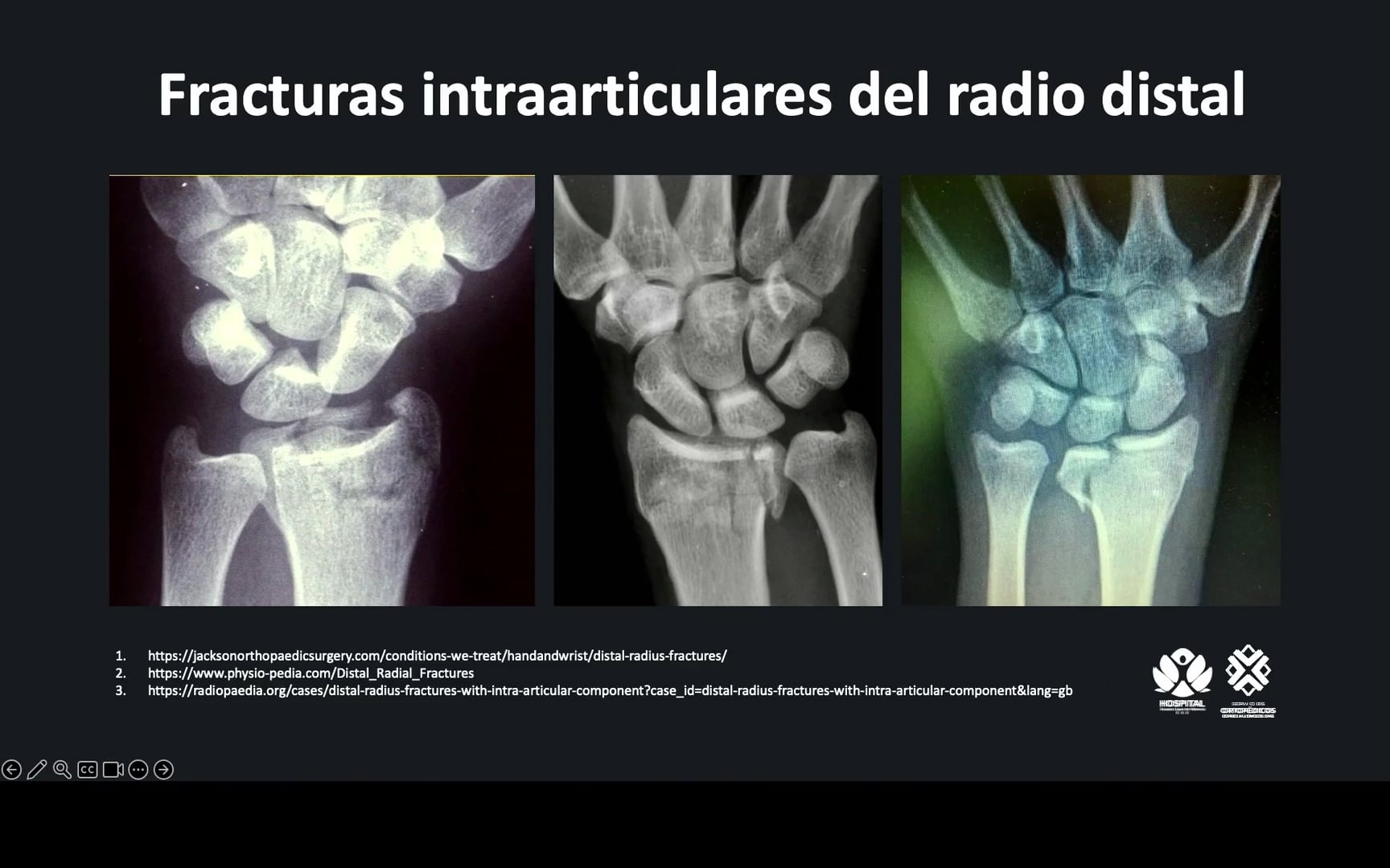 Mecanismo de trauma, examen físico e imagenología y métodos diagnósticos en el trauma de muñeca