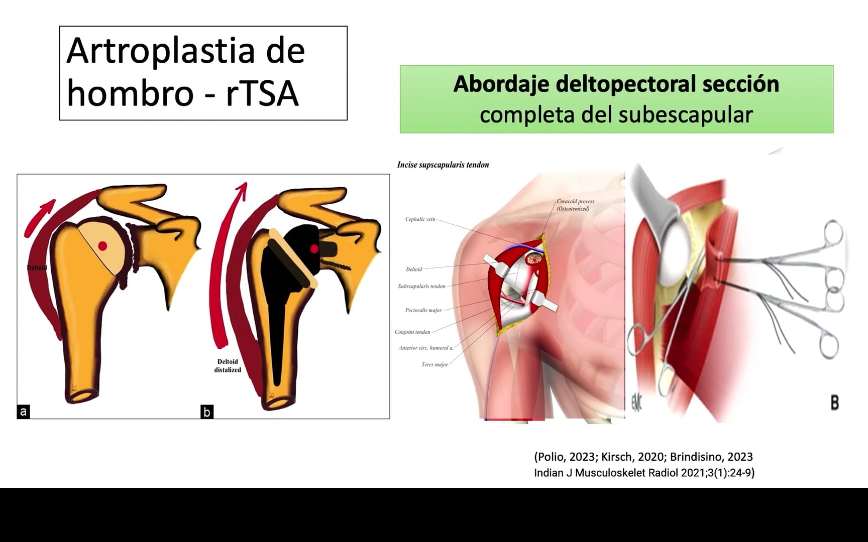 Rehabilitación perioperatorio - retorno a la actividad, lesión del hombro, énfasis en artroplastia