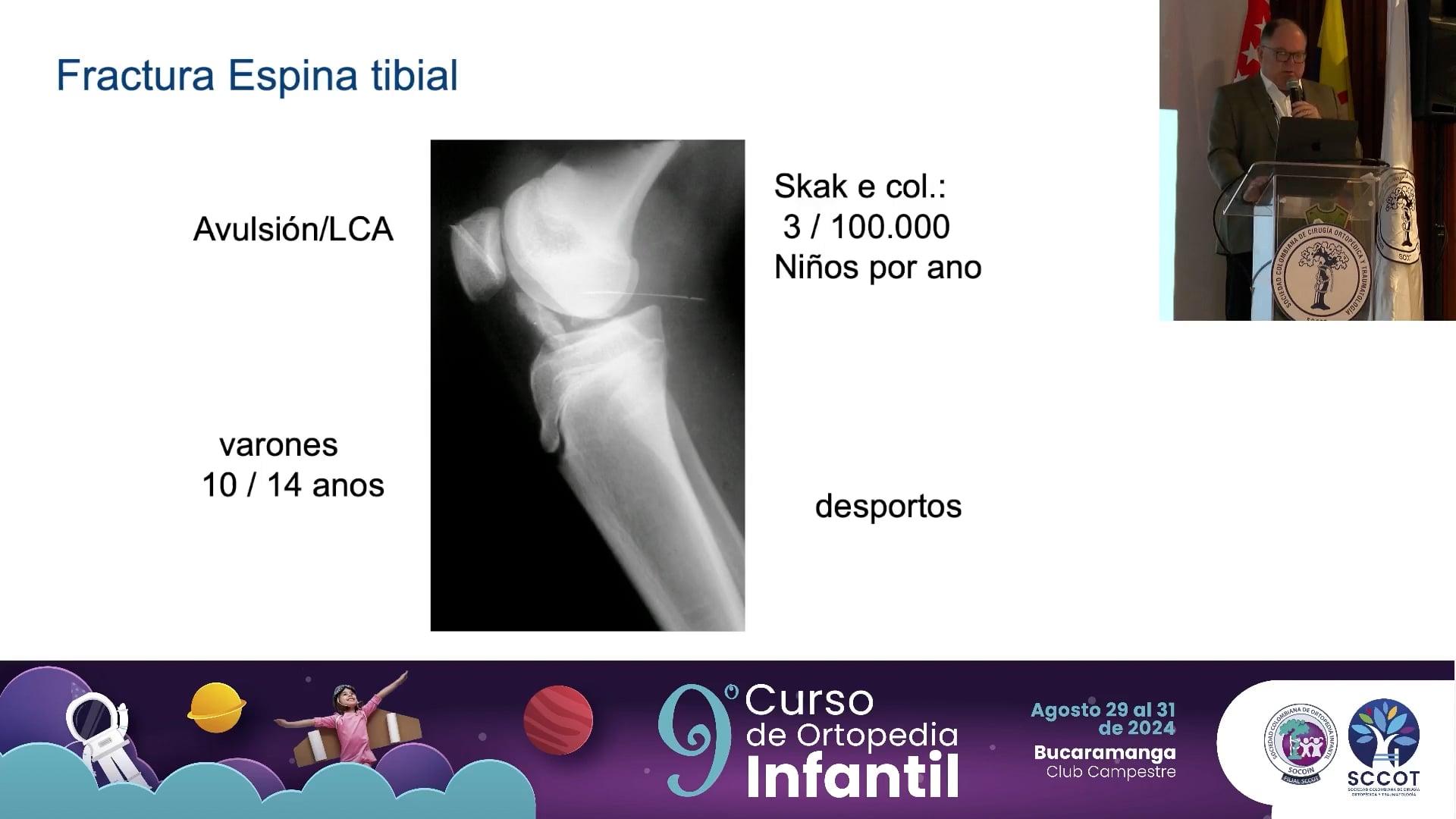 Fracturas alrededor de la rodilla aspectos importantes.