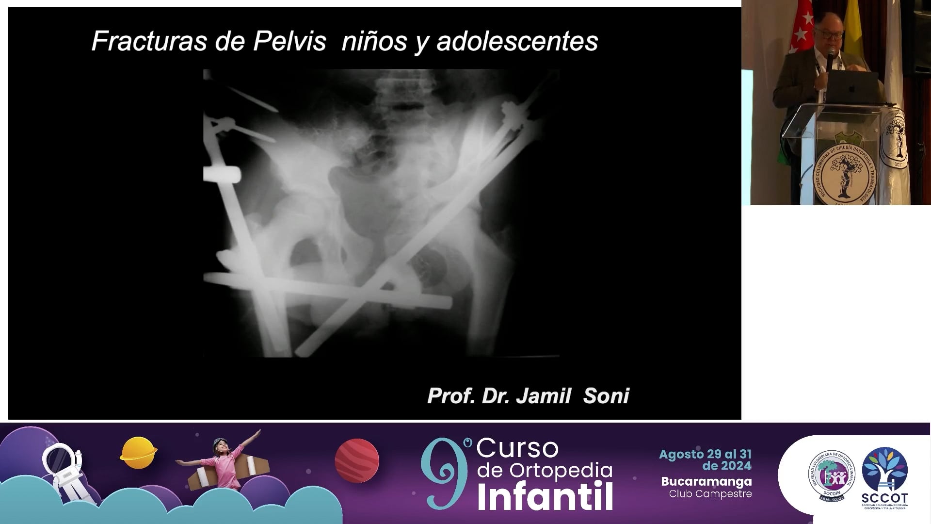 Fracturas de la pelvis en niños, son iguales a las de los adultos