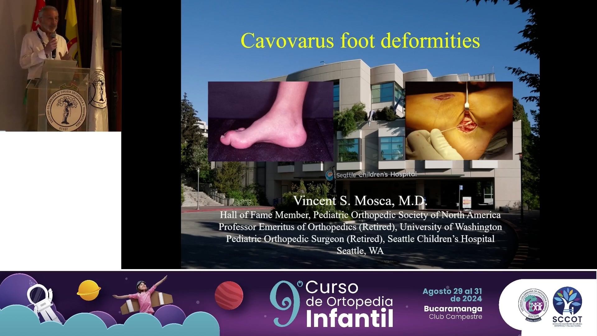 Deformidades en cavo varo del pie