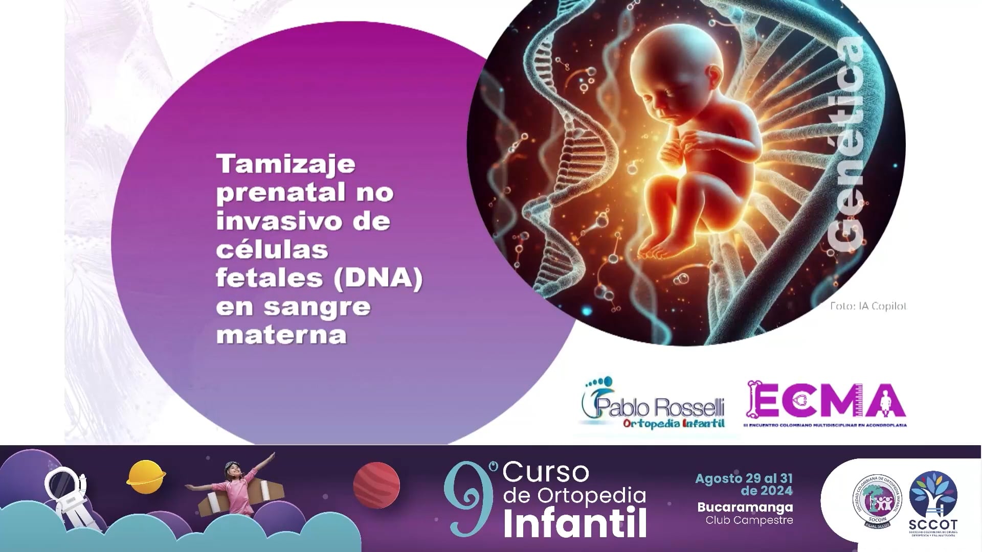 Una visión multidisciplinaria de la Acondroplasia en Colombia