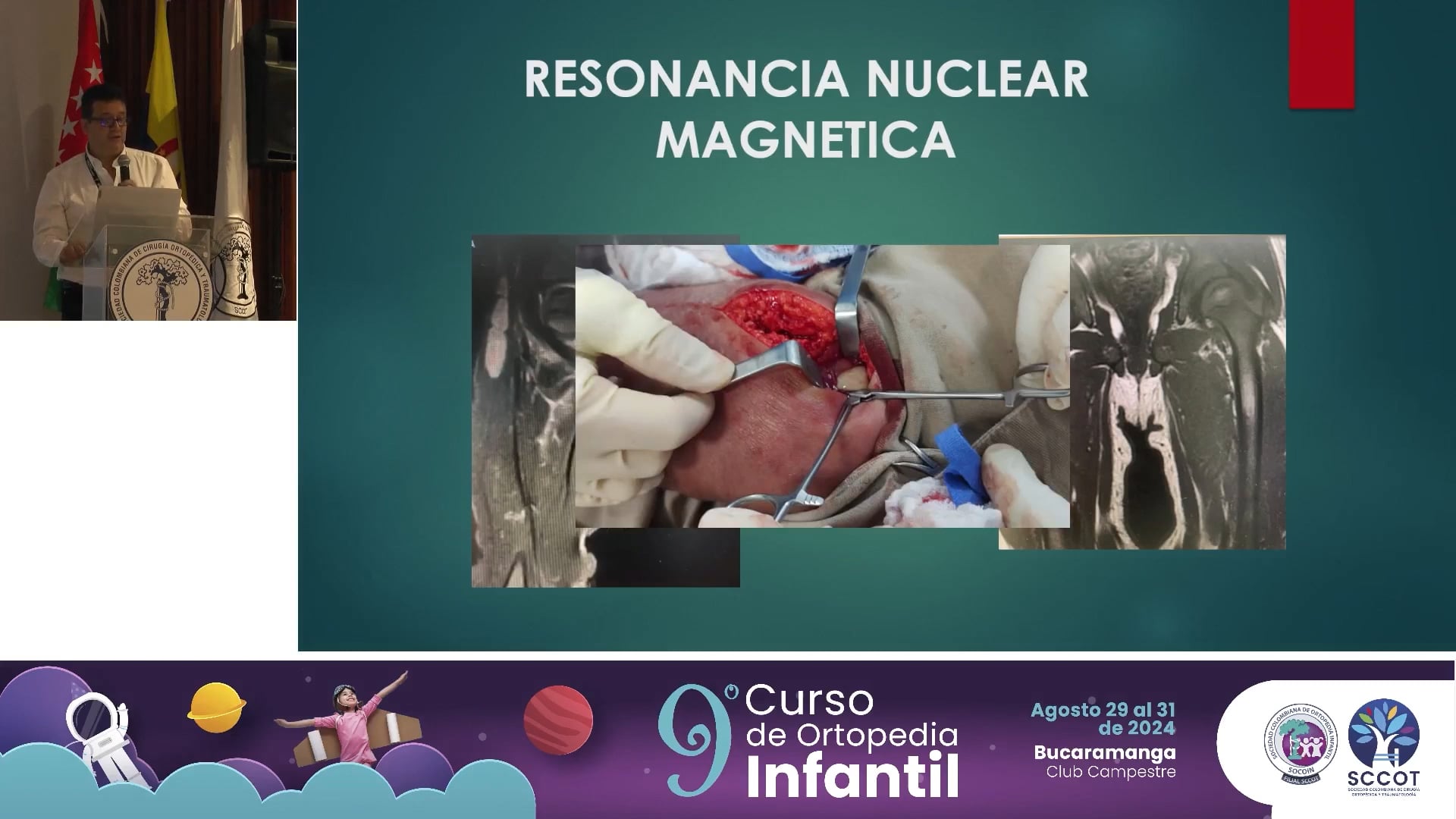 Lo nuevo en diagnóstico de infección osteoarticular en niños
