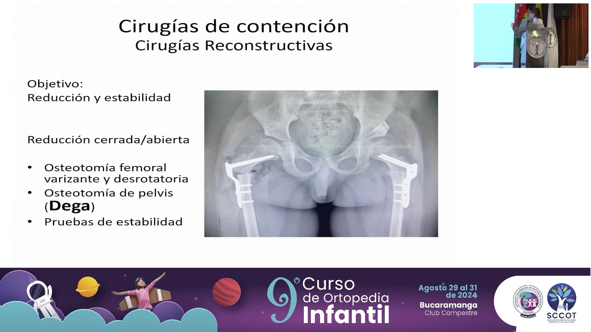 Parálisis cerebral grupo funcional IV y V Qué debo tratar