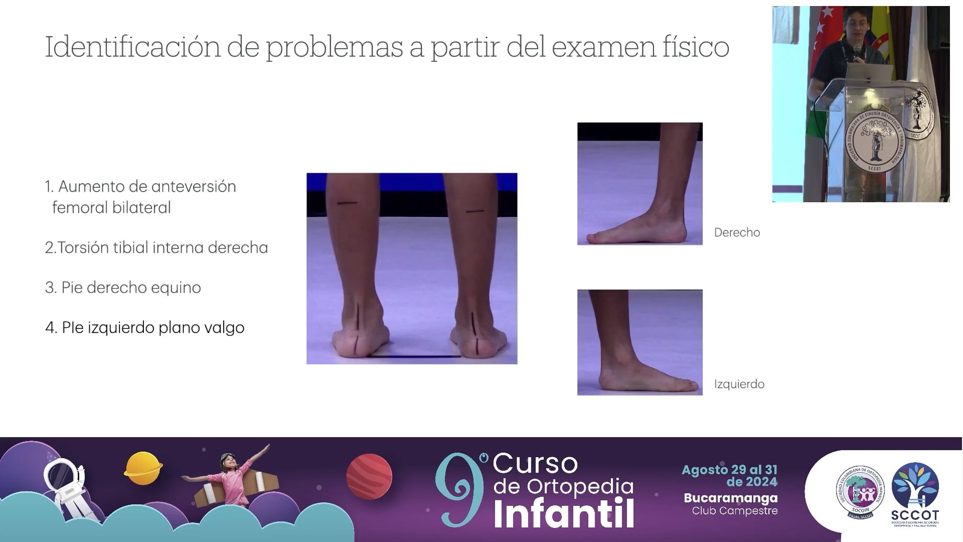 Parálisis cerebral grupo funcional I-II-III ¿Cómo determinar los problemas de la marcha?