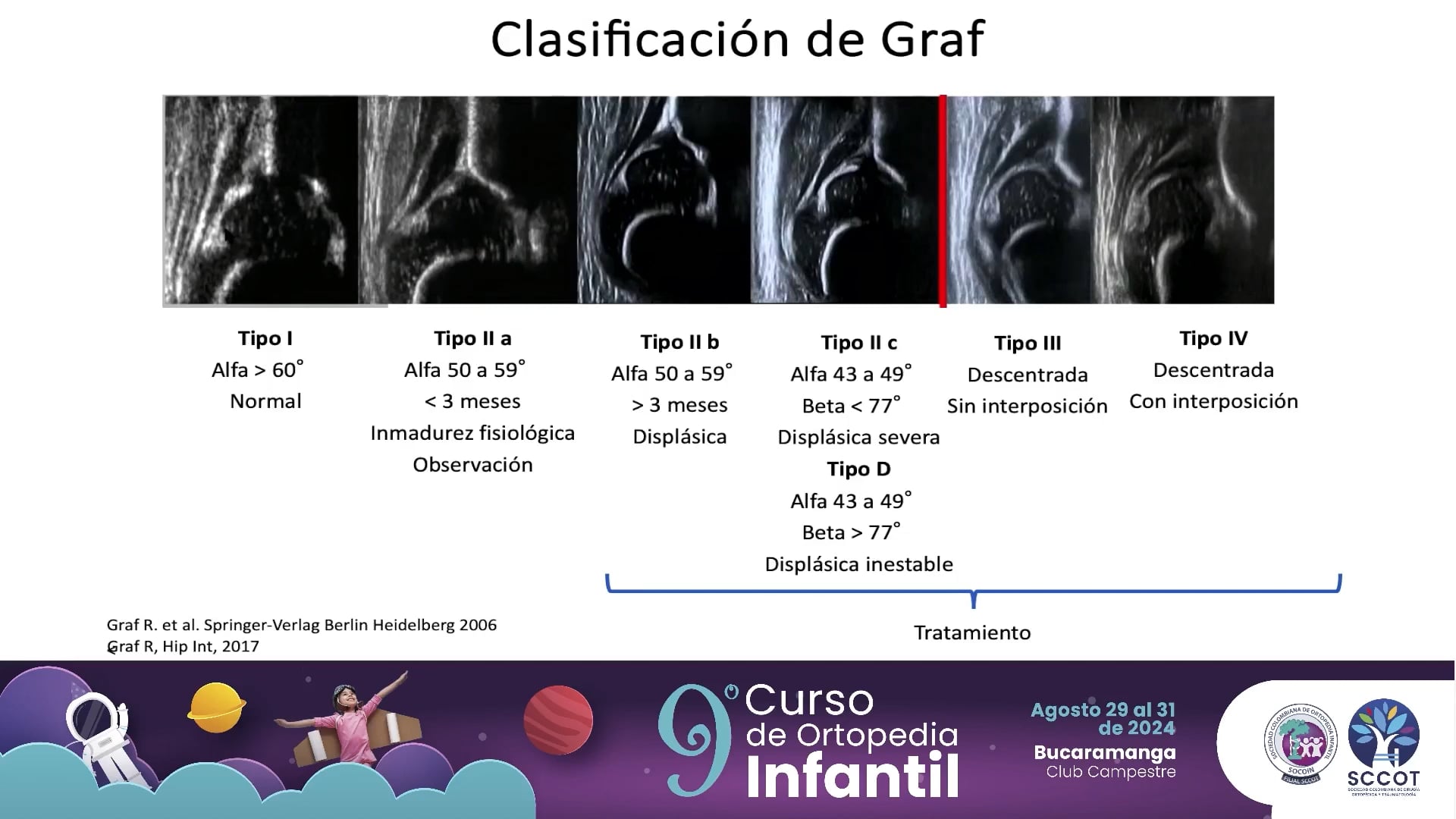 Diagnóstico temprano de displasia de caderas con ecografía.