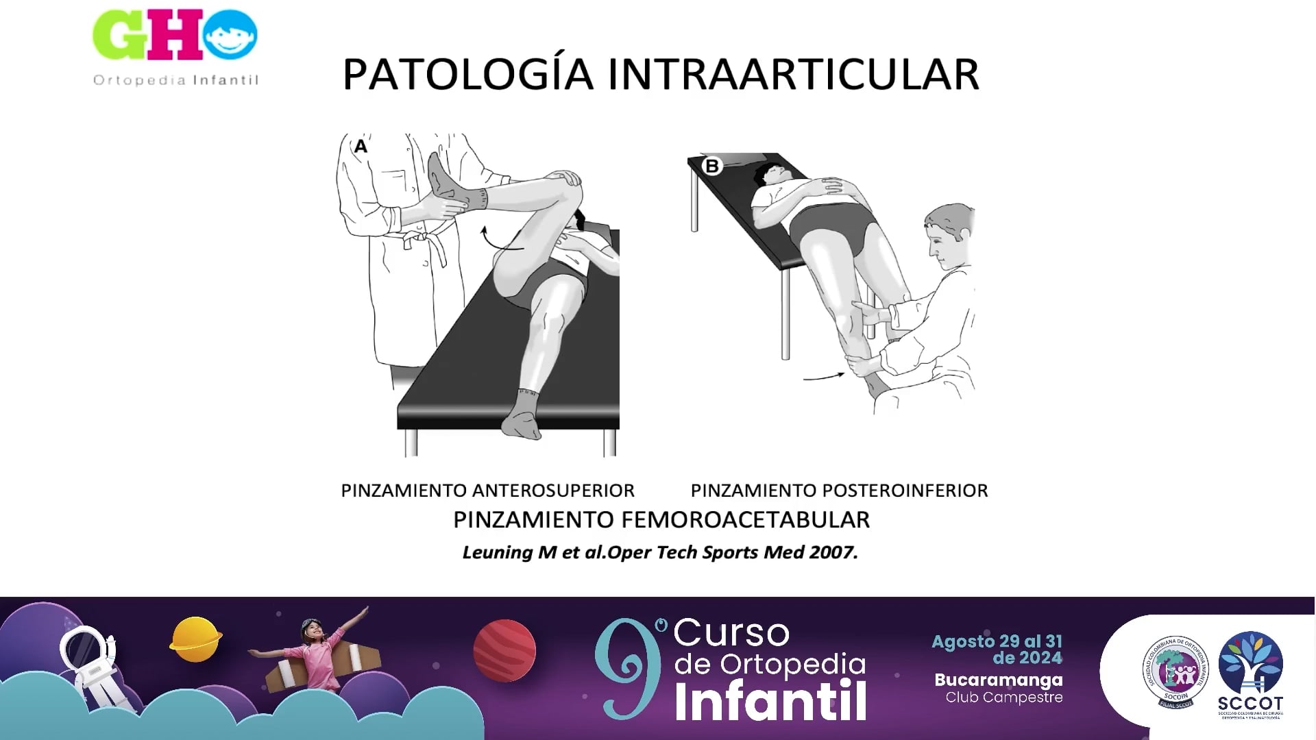 Tratamiento quirúrgico de la displasia en el adolescente.