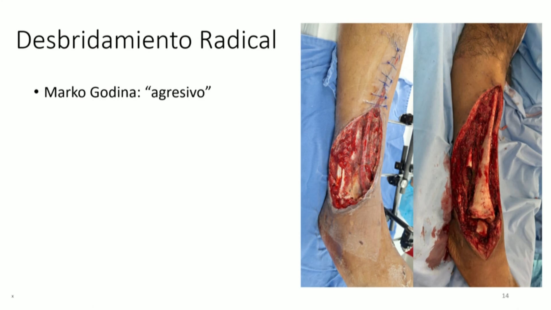 Ortoplástica ¿Me estoy metiendo donde no debo?