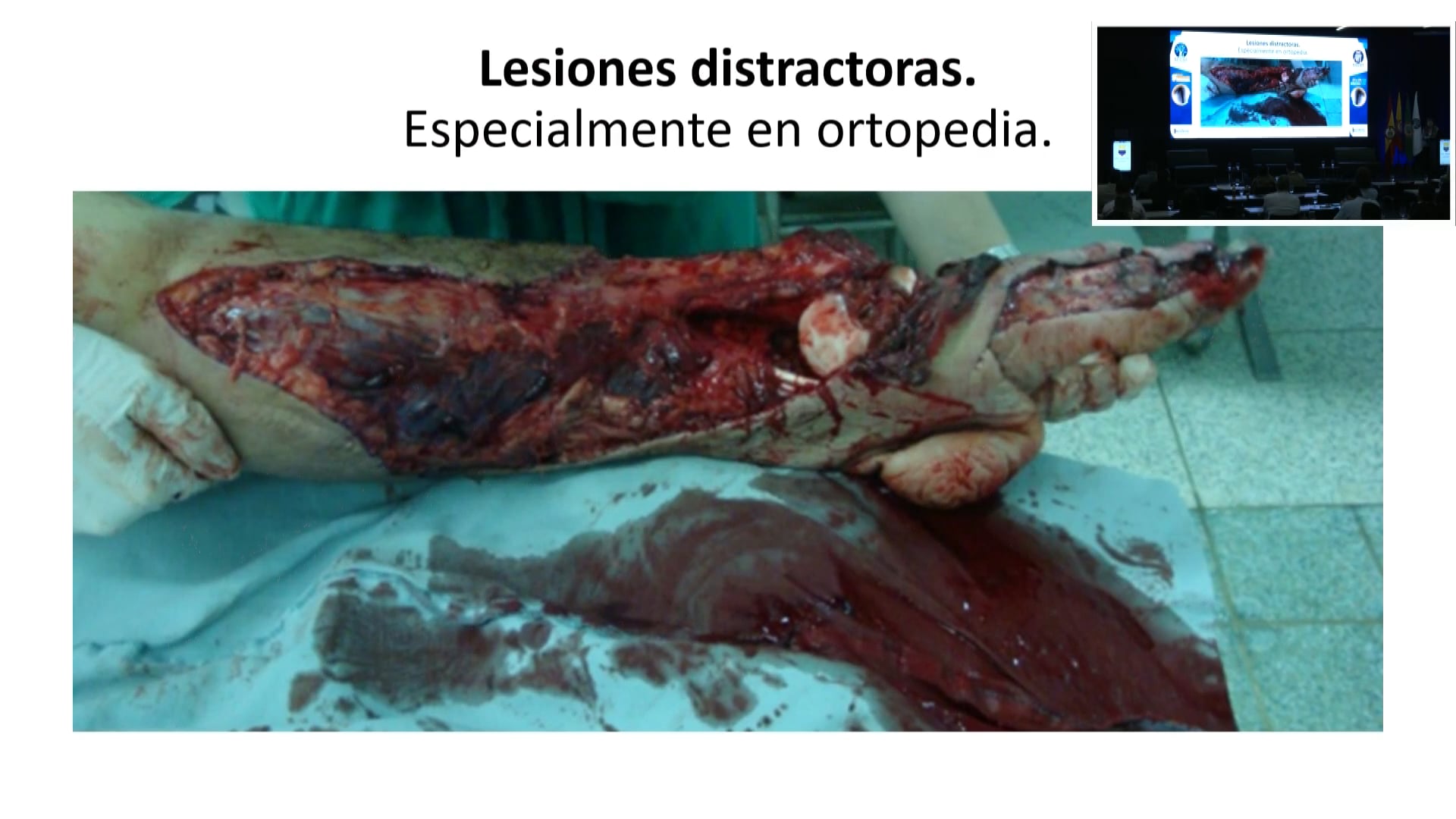 Diagnóstico inicial e intervenciones en la sala de Trauma