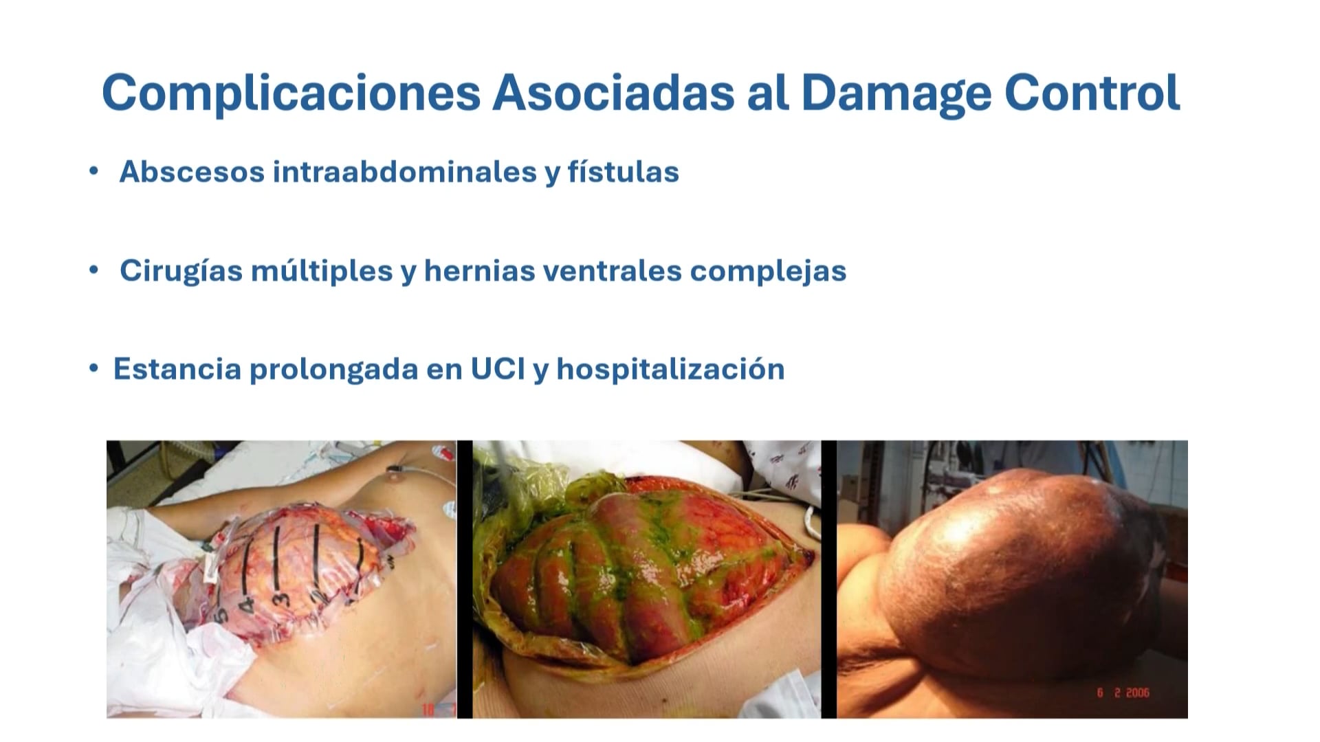 Indicaciones de Damage Control