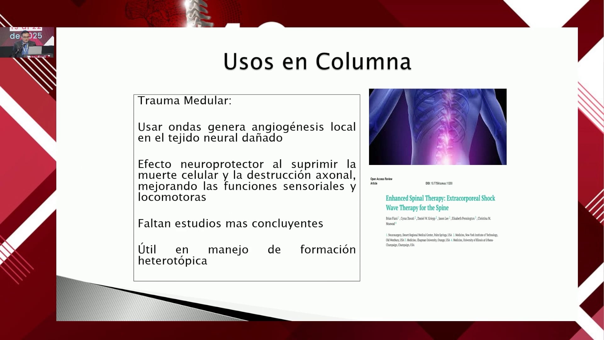 Utilidad de las ondas de choque en patología degenerativa de la columna