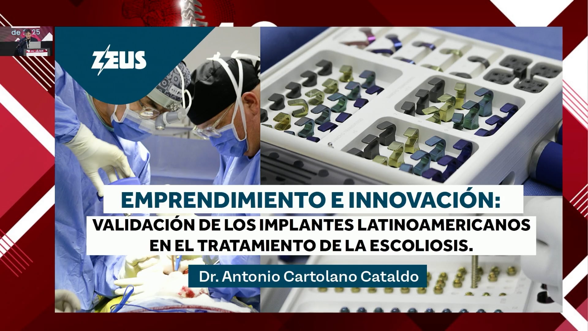 Validación de los implantes Latinoamericanos en escoliosis idiopática