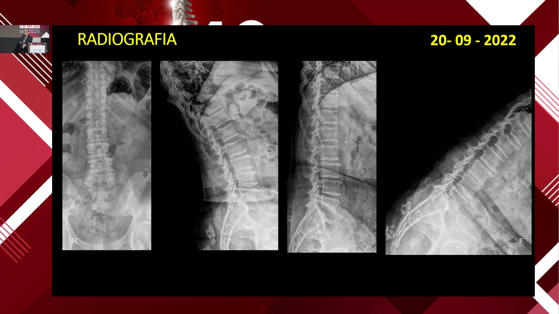 Caso Clinico