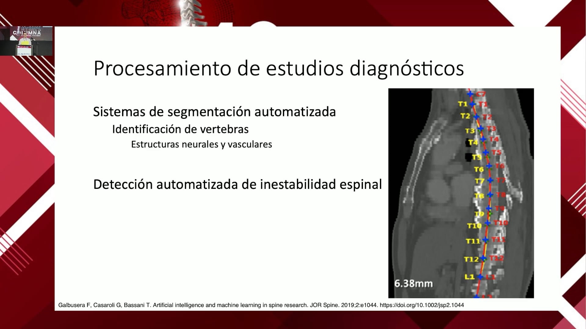 Inteligencia artificial como herramienta para manejo de patología oncológica
