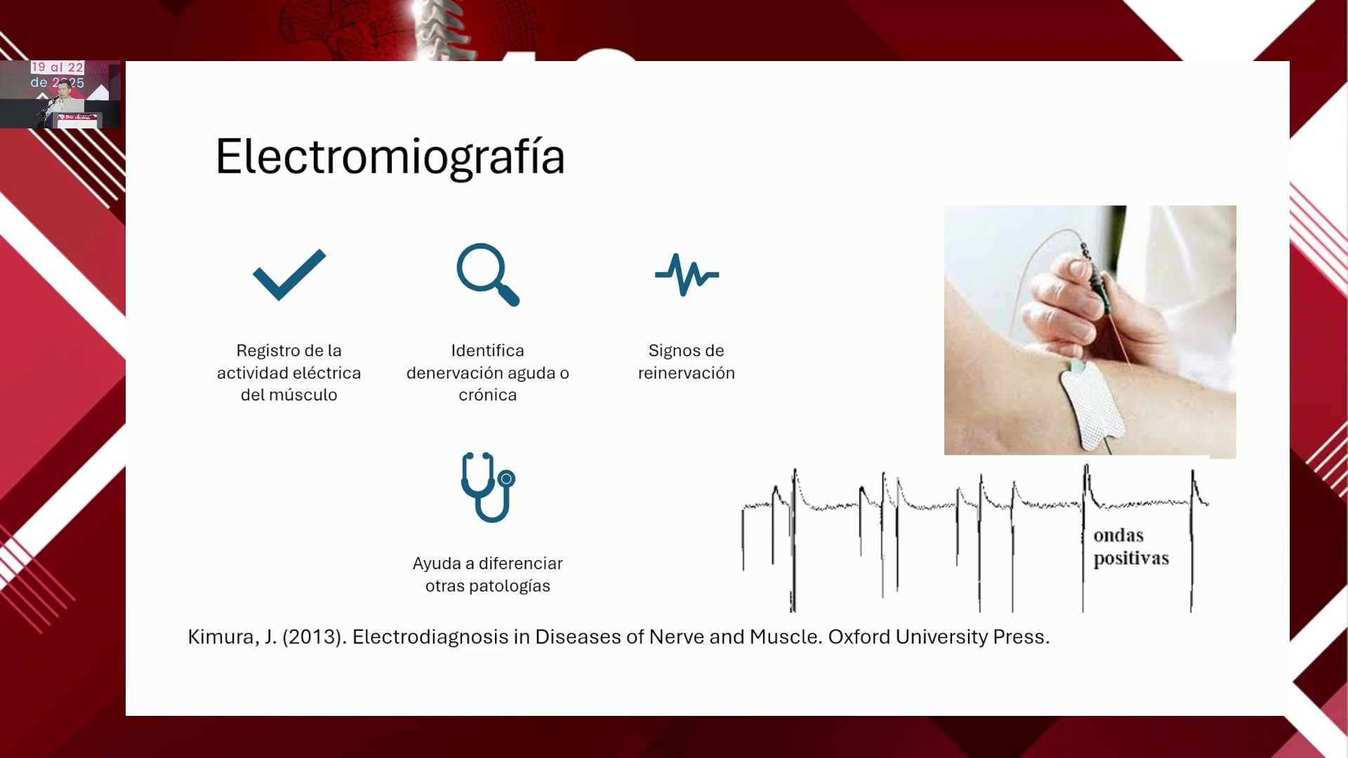 Estudios neurofisiológicos en patología degenerativa de columna
