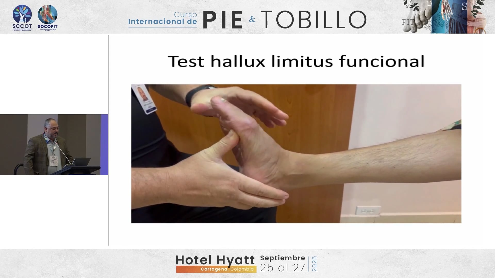 Hallux limitus de la patogenia a la cirugía