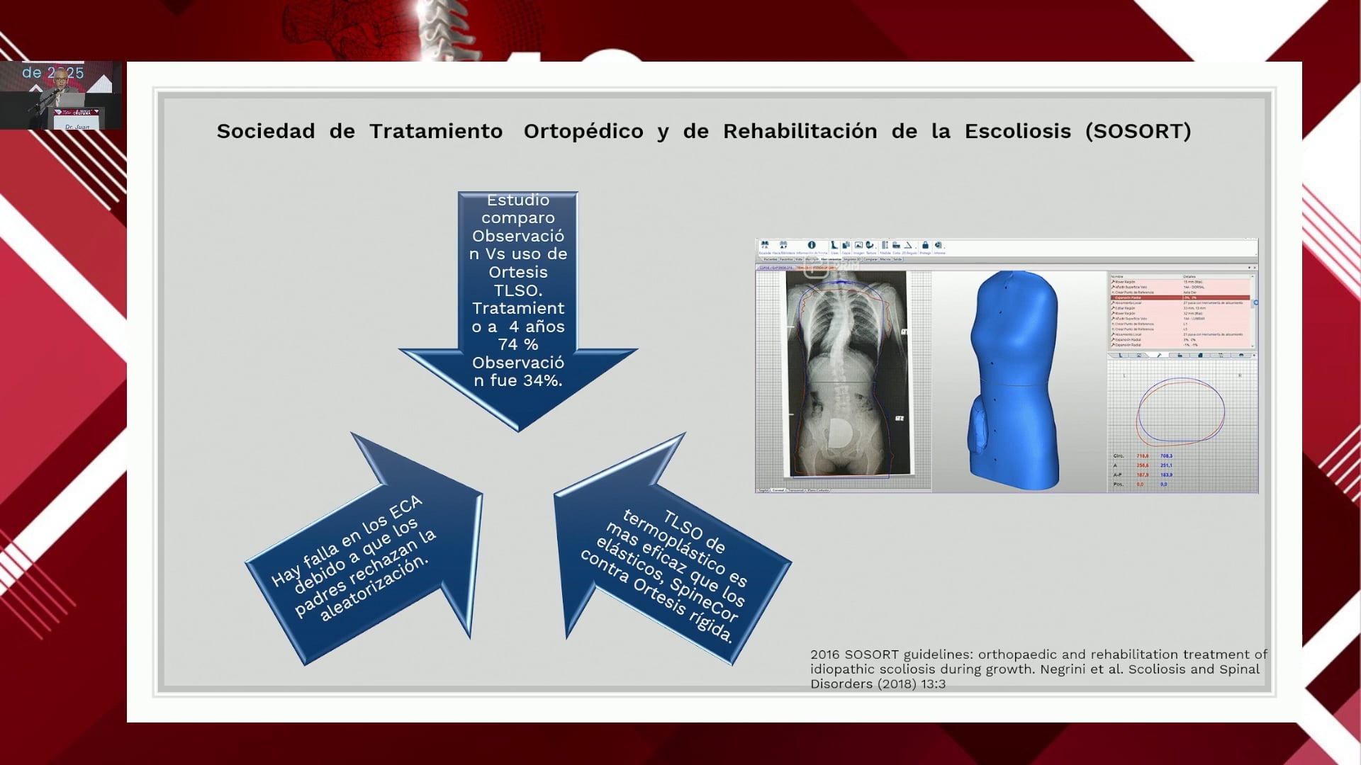 Rehabilitación del paciente con deformidades de columna