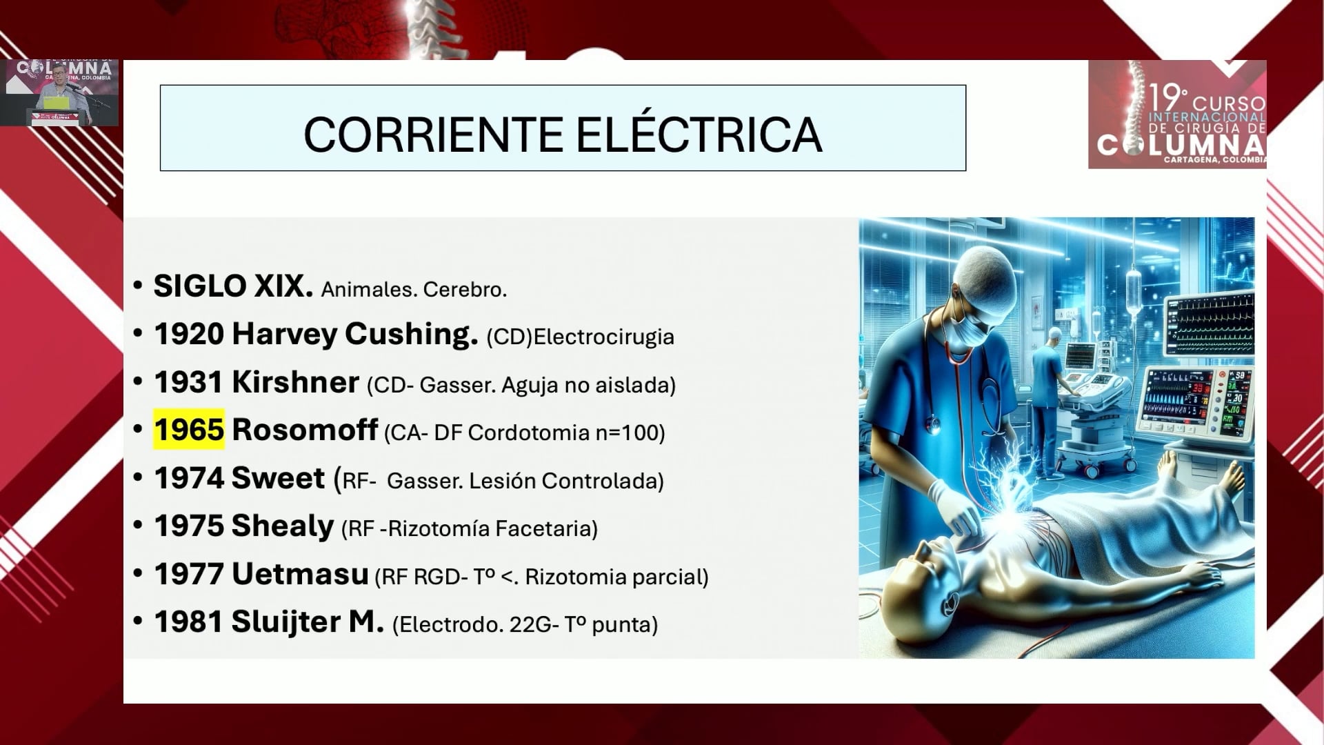 Radiofrecuencia del ganglio de la raíz dorsal - Endocanal