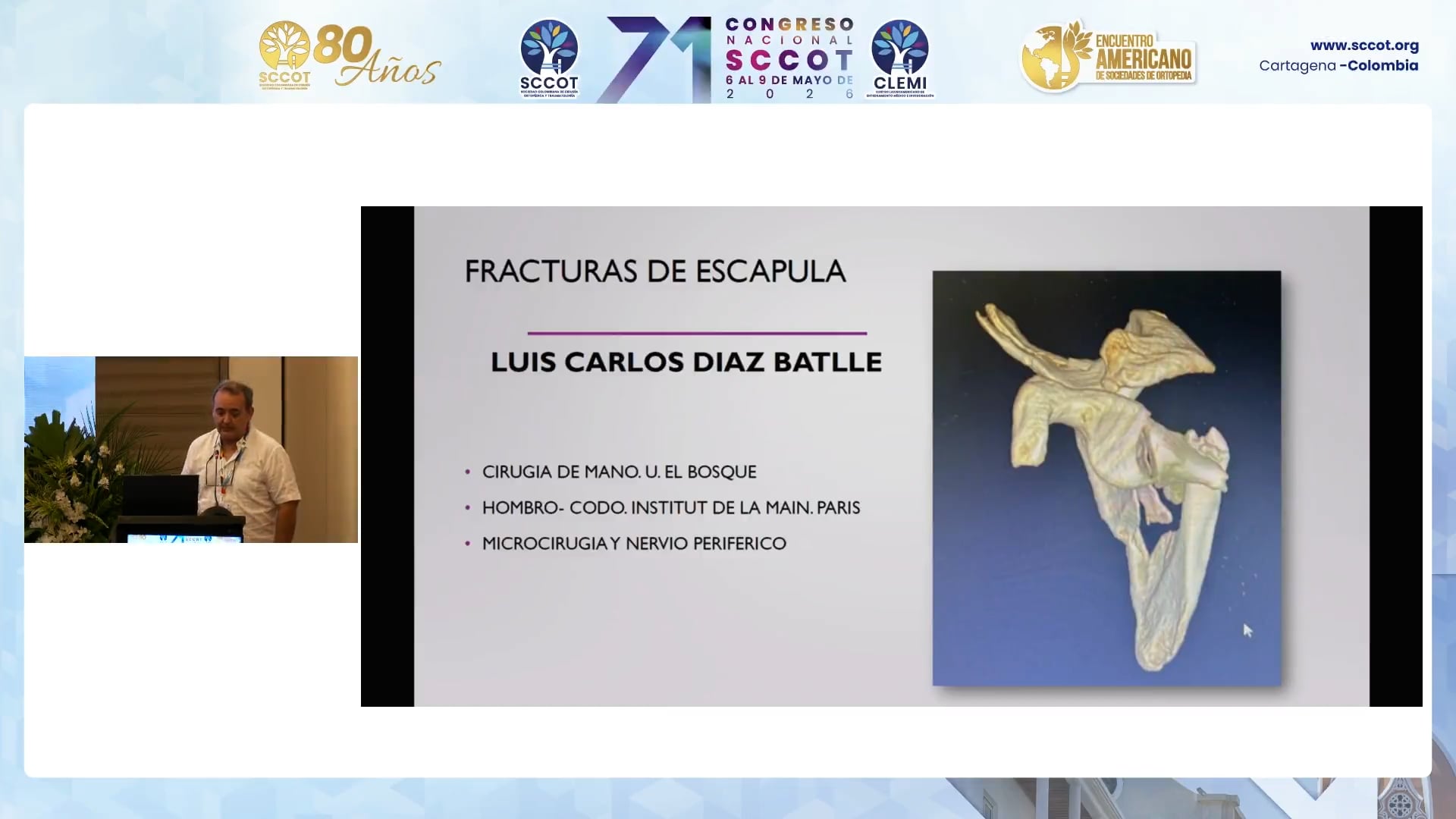 Fracturas de Escápula: Clasificación y Manejo