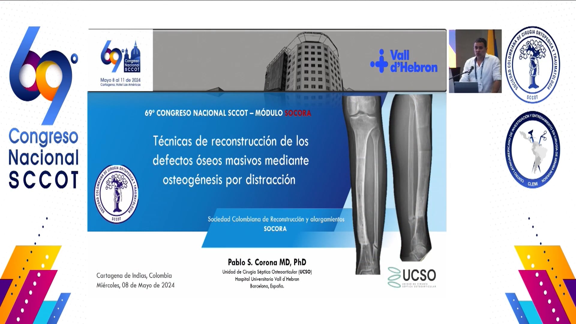 Técnicas de reconstrucción de los defectos óseos masivos mediante osteogénesis por distracción