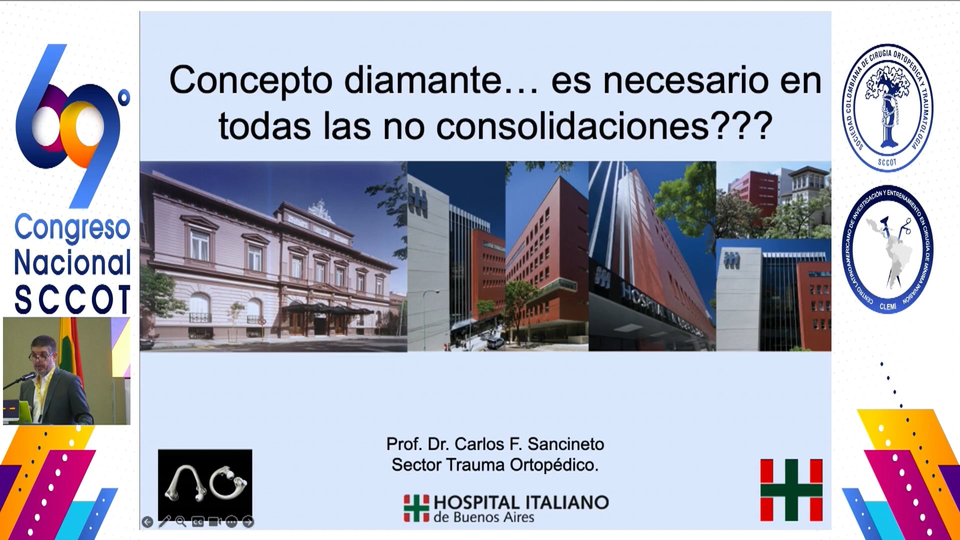 Concepto diamante Es necesario en todas las no consolidaciones