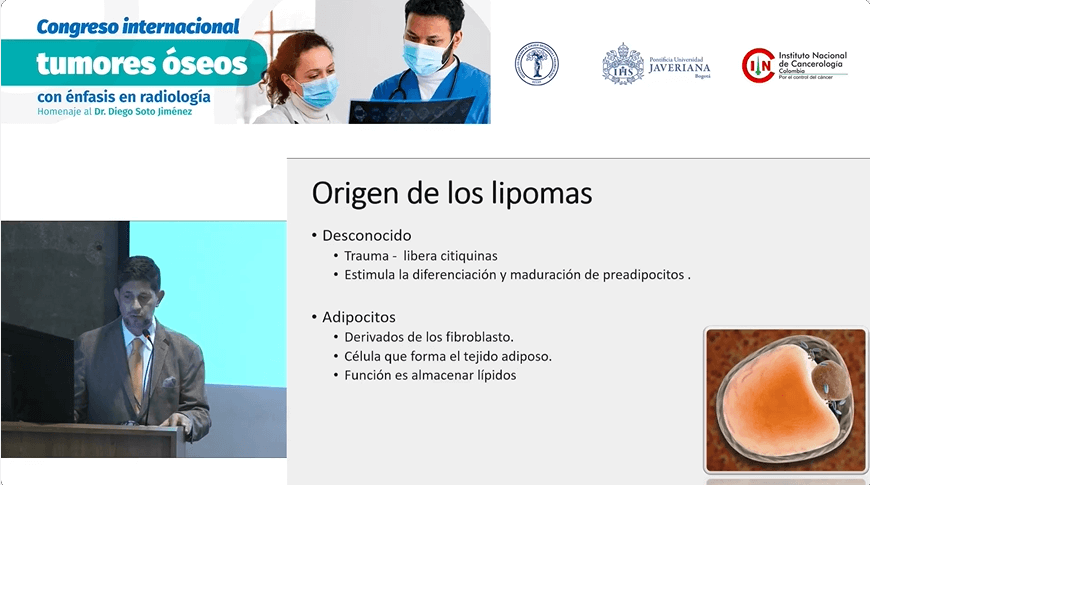 Tumores Óseos: Sarcomas de partes blandas